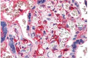 anti-Platelet Factor 4 (PF4) antibody