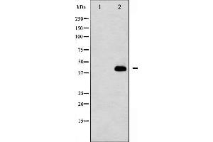 Western blot analysis of Caspase 8 (Cleaved-Asp384) expression in 293 cells, treated with etoposide,The lane on the left is treated with the antigen-specific peptide.