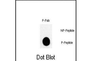 Dot blot analysis of Phospho-JUN- Pab (Cat. (C-JUN anticorps  (pThr243))
