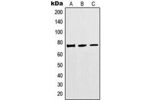 Western blot analysis of MTHFR expression in HEK293 (A), Jurkat (B), A549 (C) whole cell lysates. (MTHFR anticorps  (Center))