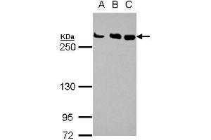 WB Image Sample (30 ug of whole cell lysate) A: Jurkat B: Raji C: K562 5% SDS PAGE antibody diluted at 1:1000