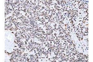 IHC analysis of Aurora A/AURKA using anti-Aurora A/AURKA antibody (ABIN7600751). (Aurora A anticorps  (AA 23-403))