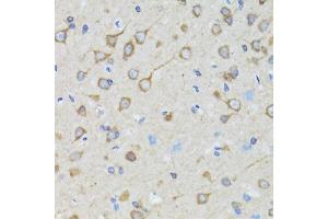 Immunohistochemistry of paraffin-embedded rat brain using TOLLIP antibody. (TOLLIP anticorps)