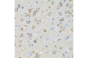 Immunohistochemistry of paraffin-embedded rat brain using TOLLIP antibody. (TOLLIP anticorps)