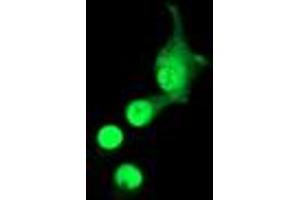 Anti-ACD mouse monoclonal antibody (ABIN2455492) immunofluorescent staining of COS7 cells transiently transfected by pCMV6-ENTRY ACD (RC204381). (ACD anticorps)