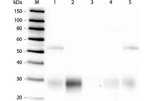 Western Blot of Anti-Rabbit IgG F(ab')2 (GOAT) Antibody . (Chèvre anti-Lapin IgG (F(ab')2 Region) Anticorps (FITC) - Preadsorbed)
