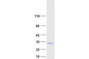 Validation with Western Blot