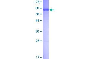 Image no. 1 for phosphoglycerate Dehydrogenase (PHGDH) (AA 1-533) protein (GST tag) (ABIN1314910)