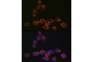 Immunofluorescence analysis of HeLa cells using IRF6 Rabbit mAb (ABIN1680921, ABIN3017588, ABIN3017589 and ABIN7101507) at dilution of 1:100 (40x lens).