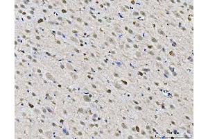 IHC analysis of ZMYND8 using anti-ZMYND8 antibody (ABIN7598947).