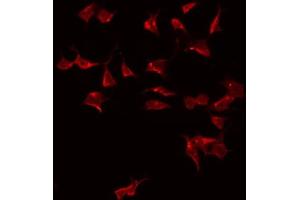 ABIN6275031 staining HeLa by IF/ICC. (C1QL2 anticorps  (C-Term))
