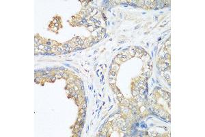 Immunohistochemistry of paraffin-embedded human prostate using CBL antibody at dilution of 1:200 (40x lens). (CBL anticorps)