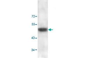 Western blot analysis of human skin lysate with ADAMTS2 polyclonal antibody  at 1 : 100 dilution. (Adamts2 anticorps  (C-Term))