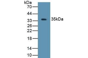 Detection of Recombinant DEFb2, Rat using Polyclonal Antibody to Defensin Beta 2 (DEFb2) (beta 2 Defensin anticorps  (AA 23-63))