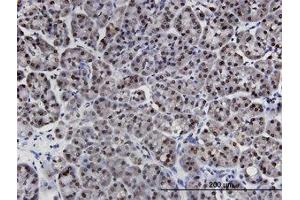 Image no. 1 for anti-LIM Domains Containing 1 (LIMD1) (AA 577-675) antibody (ABIN599481) (LIMD1 anticorps  (AA 577-675))
