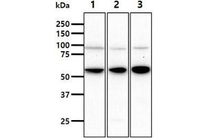 The cell lysates (40ug) were resolved by SDS-PAGE, transferred to PVDF membrane and probed with anti-human HSPA13 antibody (1:1000). (HSPA13 anticorps)