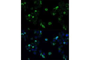 Immunofluorescence analysis of HeLa cells using ABCC4 antibody.