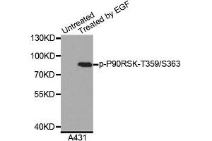 Western blot analysis of extracts of A431 cells, using Phospho-P90RSK-T359/S363 antibody (ABIN5996240). (RPS6KA3 anticorps  (pSer363, pThr359))