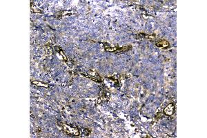 IHC analysis of MYBPC3 using anti-MYBPC3 antibody .