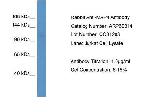 WB Suggested Anti-MAP4  Antibody Titration: 0.