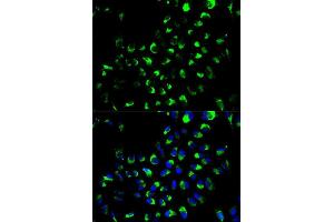 Immunofluorescence analysis of A549 cell using AK4 antibody.