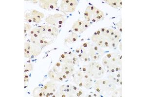 Immunohistochemistry of paraffin-embedded human stomach using RAB3IP antibody at dilution of 1:100 (x40 lens). (RAB3IP anticorps)