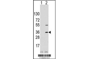 Western blot analysis of SSR1 using rabbit SSR1 Antibody using 293 cell lysates (2 ug/lane) either nontransfected (Lane 1) or transiently transfected with the SSR1 gene (Lane 2).