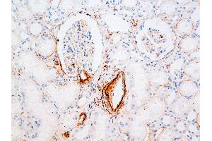 Immunohistochemistry (IHC) image for anti-Vitronectin (VTN) antibody (ABIN108419) (Vitronectin anticorps)