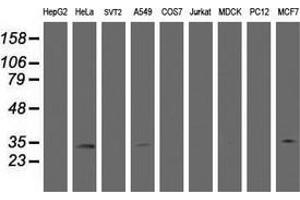 Western Blotting (WB) image for anti-Hydroxysteroid (17-Beta) Dehydrogenase 8 (HSD17B8) (AA 57-261) antibody (ABIN2715556) (HSD17B8 anticorps  (AA 57-261))