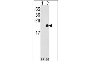 Western blot analysis of PRDX1 (arrow) using rabbit polyclonal PRDX1 Antibody (Center) (ABIN389467 and ABIN2839531). (Peroxiredoxin 1 anticorps  (AA 88-116))