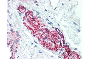 Anti-Nestin antibody IHC of human prostate, nerve. (Nestin anticorps)