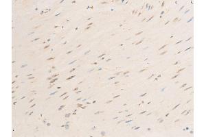 ABIN6267070 at 1/100 staining human heart tissue sections by IHC-P.