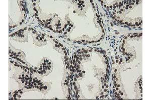 Image no. 6 for anti-Nonhomologous End-Joining Factor 1 (NHEJ1) antibody (ABIN1499729) (NHEJ1 anticorps)