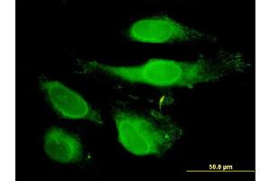 Immunofluorescence of monoclonal antibody to PRDX2 on HeLa cell. (Peroxiredoxin 2 anticorps  (AA 1-198))