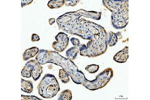 IHC analysis of ANGPTL4 using anti-ANGPTL4 antibody (ABIN5518734). (ANGPTL4 anticorps  (C-Term))