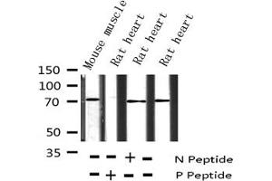 Western blot analysis of Phospho-p70 S6 Kinase (Ser411) expression in various lysates