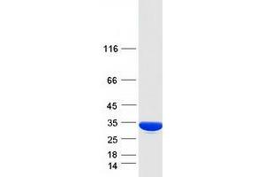 Validation with Western Blot