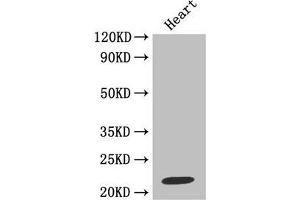 Western blotAll lanes: Metalloproteinase inhibitor 1 antibody at 2 μg/mlLane 1: Jurkat whole cell lysateLane 2: MCF-7 whole cell lysateSecondaryGoat polyclonal to rabbit at 1/10000 dilutionPredicted band size: 23 kDaObserved band size: 23 kDa. (TIMP1 anticorps  (AA 24-207))