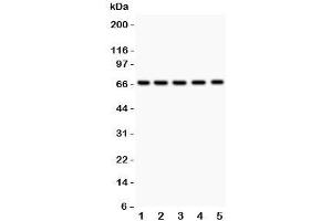 Western blot testing of HNF1A antibody and Lane 1:  rat liver;  2: (r) kidney;  3: (r) RH35;  4: human HeLa;  5: (h) HEPG2. (HNF1A anticorps  (AA 431-631))