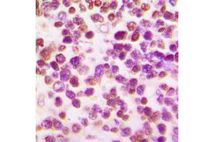 Immunohistochemical analysis of OCT2 staining in human tonsil formalin fixed paraffin embedded tissue section.