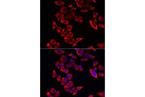 Immunofluorescence analysis of MCF-7 cells using RPL9 antibody. (RPL9 anticorps  (AA 1-192))