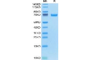 Mouse AFP on Tris-Bis PAGE under reduced condition.