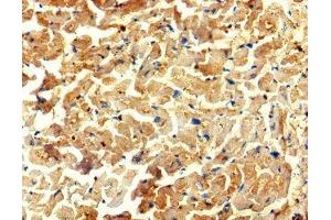 Immunohistochemistry of paraffin-embedded human heart tissue using ABIN7175734 at dilution of 1:100 (WDR27 anticorps  (AA 501-730))