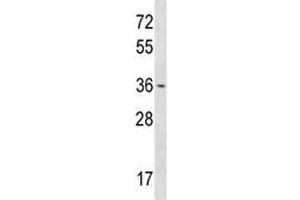 OTX1 antibody western blot analysis in T47D lysate.