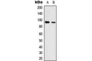 Western blot analysis of Neuroligin 3 expression in HEK293T (A), NS-1 (B) whole cell lysates. (Neuroligin 3 anticorps  (C-Term))