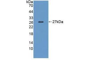 Western blot analysis of recombinant Human LRP1B. (LRP1B anticorps  (AA 31-194))