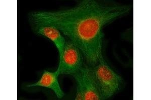 IF analysis of RIMKLB and Tubulin beta using anti-RIMKLB antibody (ABIN7600908) and anti-Tubulin beta antibody (ABIN7602744).