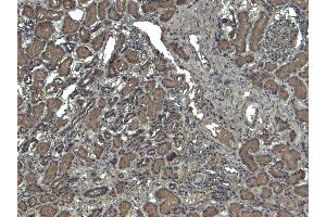 (ABIN185651) (4 μg/mL) staining of paraffin embedded Human Kidney. (Catalase anticorps  (Internal Region))