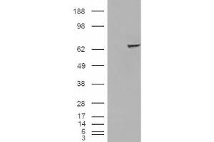 Western Blotting (WB) image for anti-Insulin-Like Growth Factor 2 mRNA Binding Protein 2 (IGF2BP2) (C-Term) antibody (ABIN2466526) (IGF2BP2 anticorps  (C-Term))