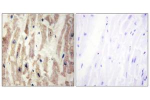 Immunohistochemistry analysis of paraffin-embedded human heart tissue using LAMA4 antibody. (LAMa4 anticorps  (Internal Region))